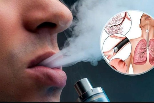 Phòng, chống tác hại của thuốc lá: Khói thuốc điện tử âm thầm hại người bên cạnh